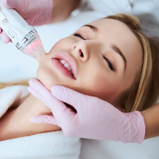 Microneedling with Radiofrequency